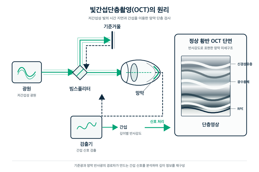 빛간섭단층촬영(OCT), 눈에 닿지 않고 망막을 어떻게 보나요? 원리 도해