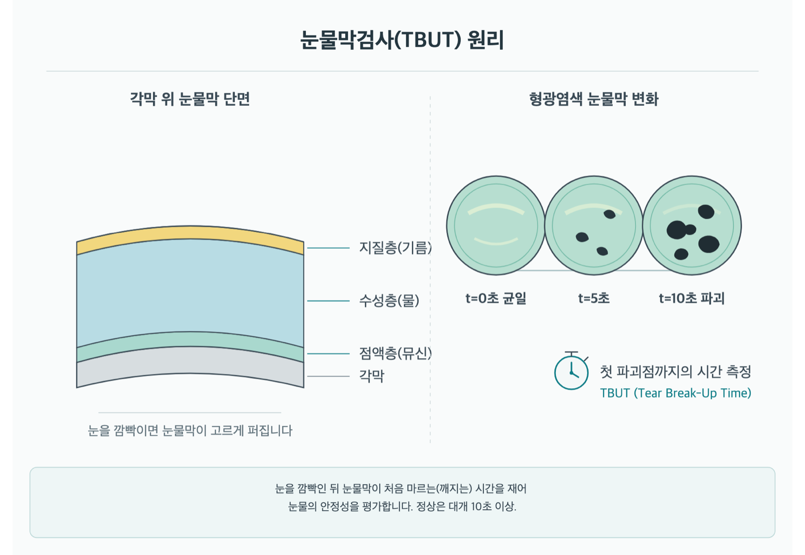 눈물막검사, 눈물이 얼마나 빨리 마르는지 알 수 있나요? 원리 도해