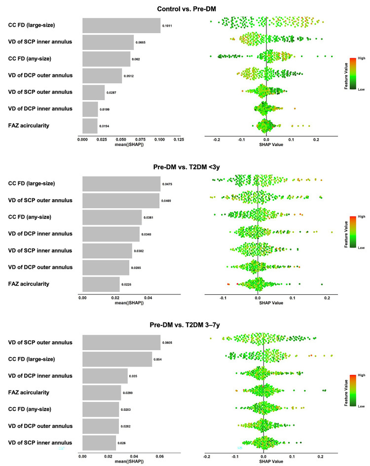 SHAP summary plots — 건강 대조군 vs 당뇨병전단계, 당뇨병전단계 vs 제2형 당뇨병 3년 미만, 당뇨병전단계 vs 제2형 당뇨병 3–7년 세 비교에서 각 OCTA 지표의 평균 |SHAP| 기여도(왼쪽)와 개별 샘플 분포(오른쪽).