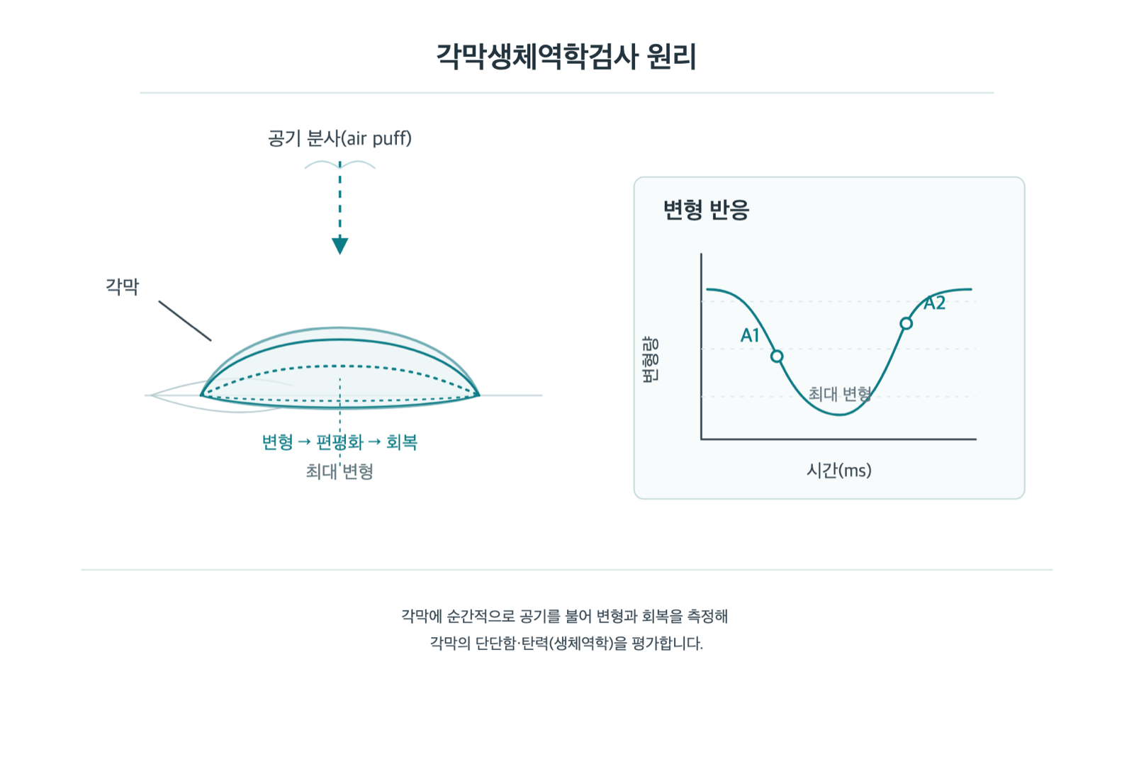각막생체역학검사, 바람만 불어도 각막의 단단함을 알 수 있나요? 원리 도해