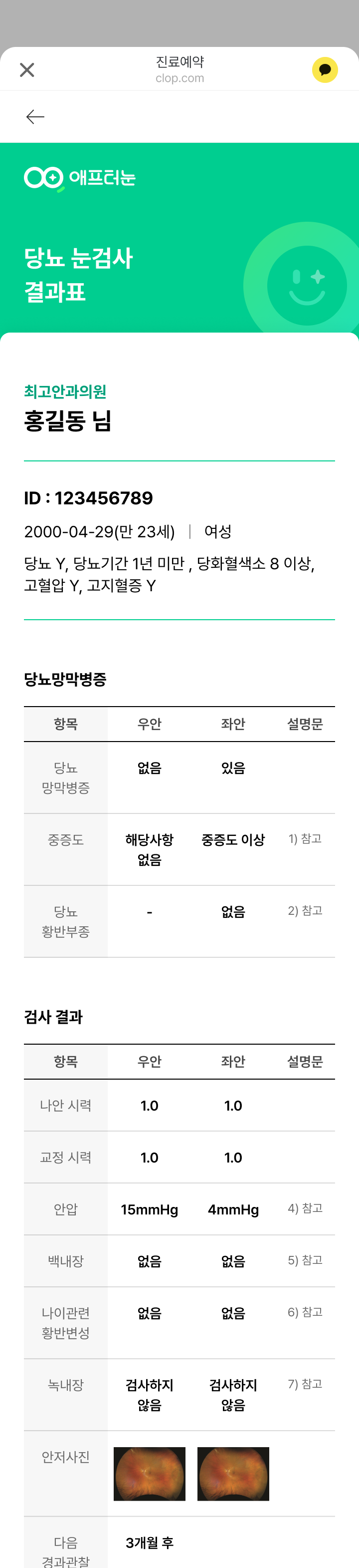 카카오톡에서 열어보는 모바일 눈검사 결과지